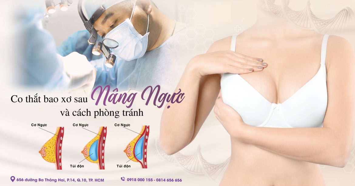 Cách phòng ngừa co thắt bao xơ sau nâng ngực - Bác sĩ Thẩm mỹ Hiếu Liêm quận 10