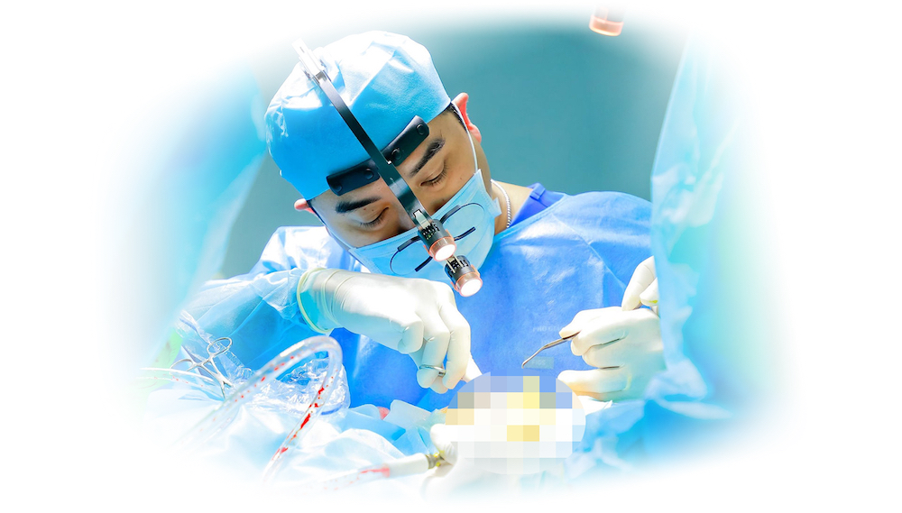 Nhược điểm của sụn surgiform nâng mũi - bác sĩ hiếu liêm quận 10