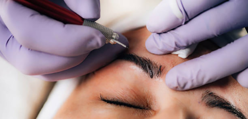 Phẫu thuật treo chân mày bao lâu xăm mày được - Bác sĩ Hiếu Liêm quận 10