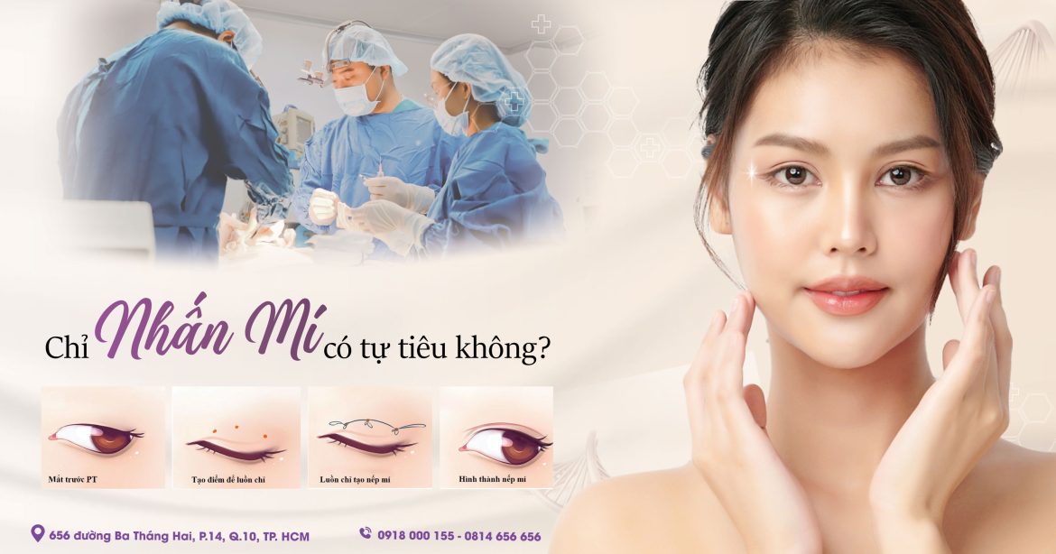 Chỉ dùng trong nhấn mí có tự tiêu không - Bác sĩ Hiếu Liêm quận 10