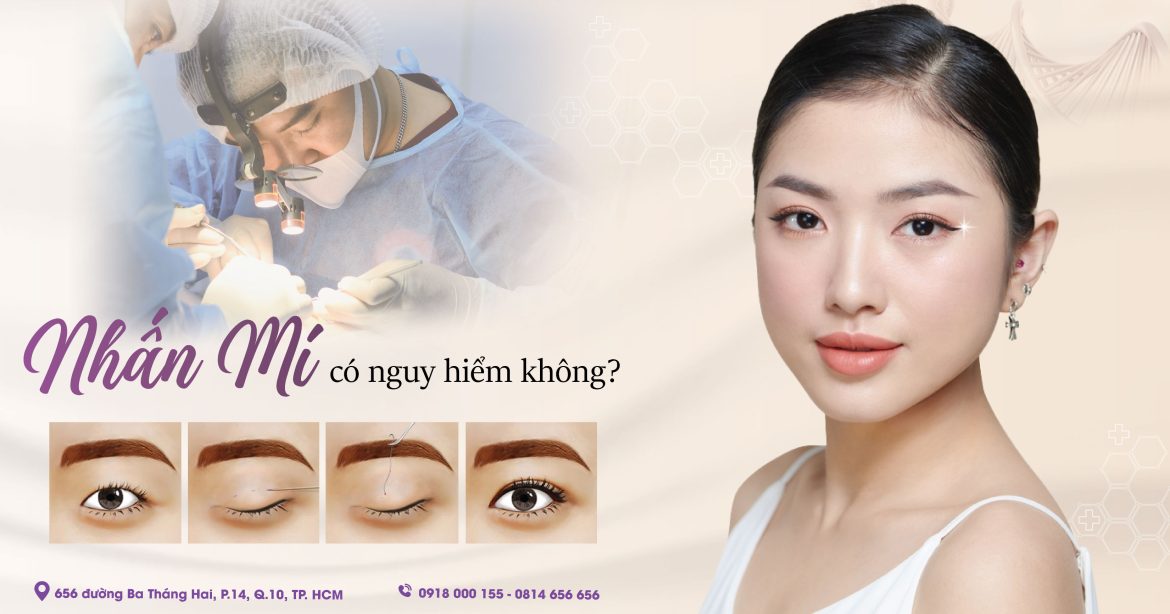 Nhấn mí hay bấm mí mắt có nguy hiểm không - Bác sĩ nhấn mí đẹp Hiếu Liêm quận 10