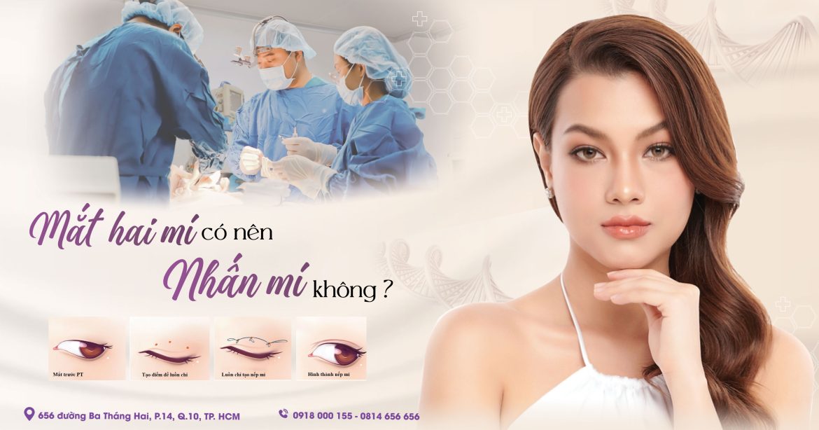 Mắt 2 mí rồi có nên nhấn mí không - Bác sĩ nhấn mí mắt đẹp quận 10 DrHieuLiem