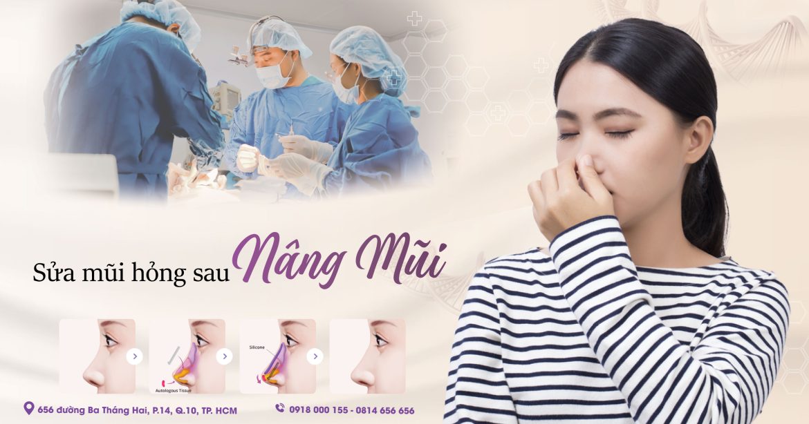 Mũi hỏng sau nâng mũi sửa được không - Bác sĩ sửa mũi uy tín quận 10 - Drhieuliem