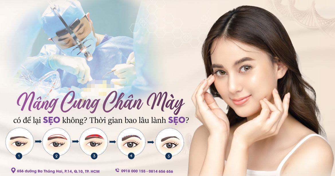 Nâng cung chân mày có để lại sẹo không và bao lâu hết - Dr Hiếu Liêm quận 10