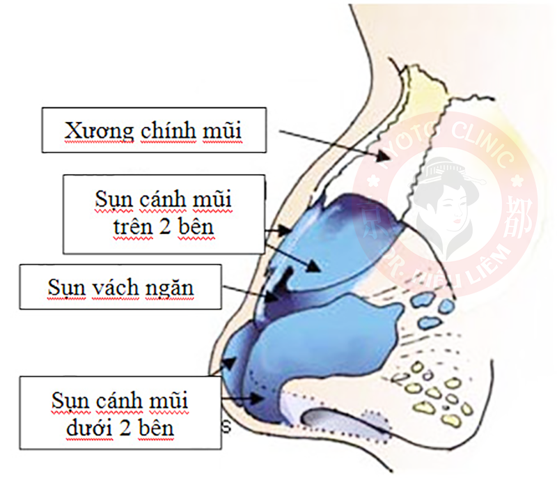 Sụn vách ngăn nằm ở đâu - Bác sĩ làm mũi đẹp quận 10 - Dr Hiếu Liêm