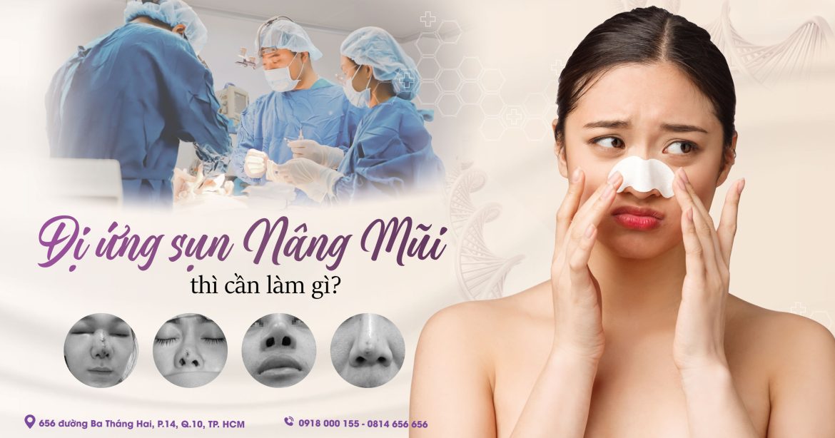 Dị ứng sụn nâng mũi là gì - Bác sĩ nâng mũi an toàn - Dr Hiếu Liêm quận 10