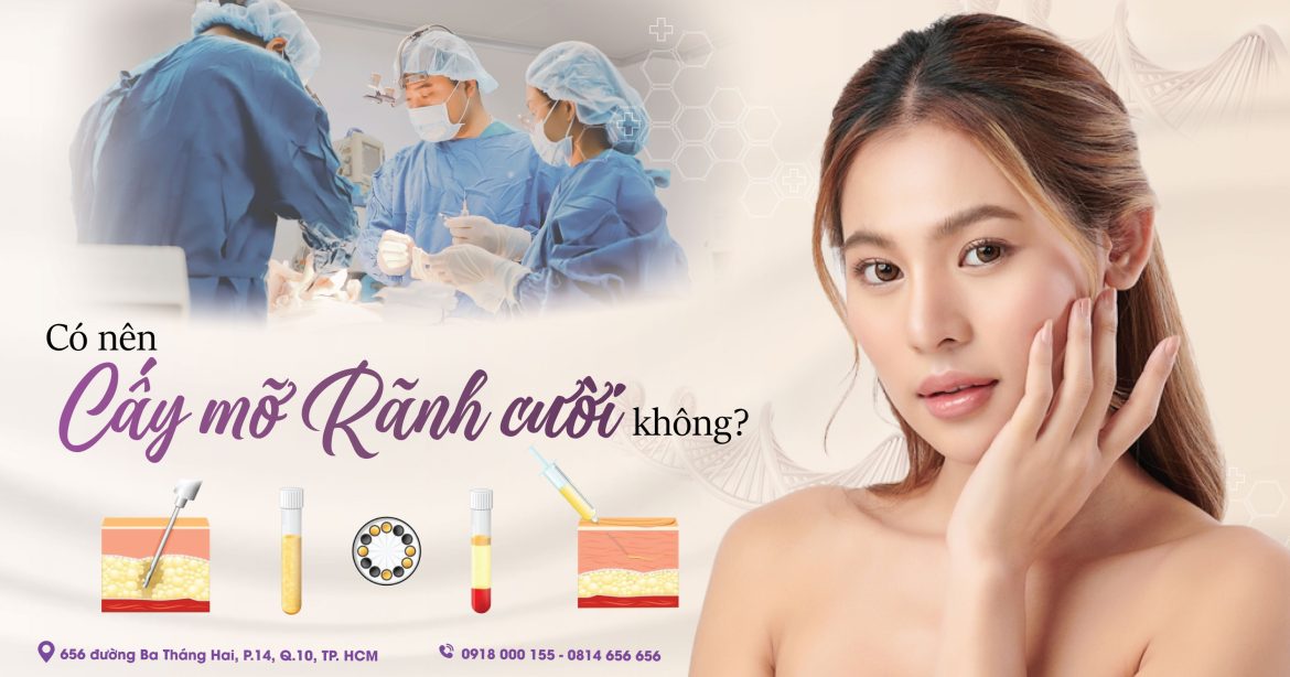 Cấy mỡ tự thân rãnh cười có tốt không - Bác sĩ thẩm mỹ uy tín dr hiếu Liêm quận 10