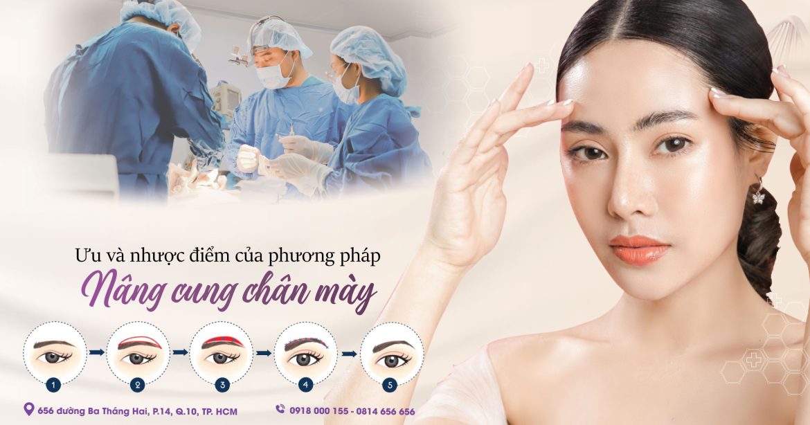 Có nên nâng cung chân mày không - Bác sĩ treo chân mày đẹp - Dr HIếu Liêm