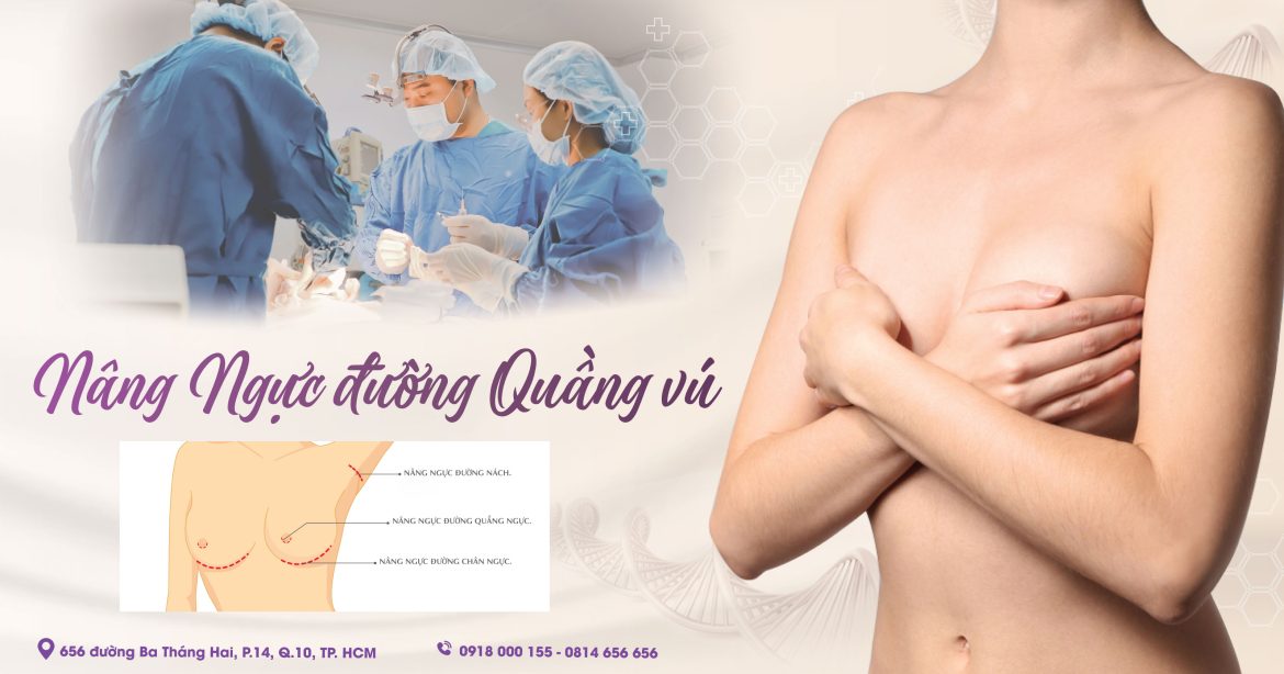 Nâng ngực đừng quầng vú có tốt không - Bác sĩ nâng ngực uy tín quận 10 Dr Hiếu Liêm