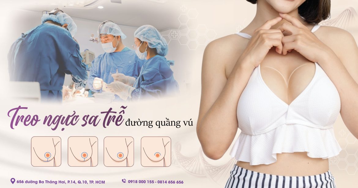 Treo ngực chảy xệ đường quầng vú có tốt không - Bác sĩ Hiếu Liêm quận 10