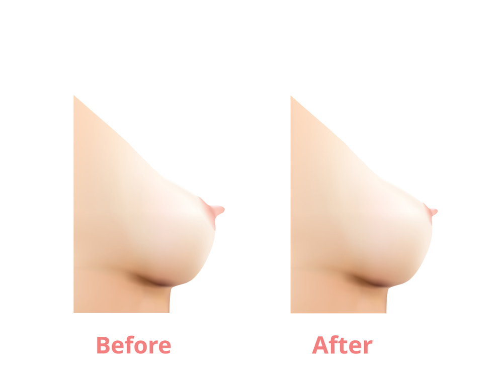 Kết quả trước sau -Dr.Hiếu Liêm Q.10