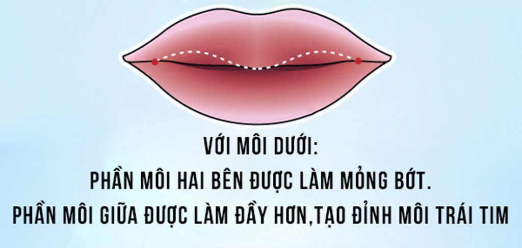 Tạo hình môi trái tim-Tạo hình môi quyến rũ- Môi dưới- Dr.Hiếu Liêm