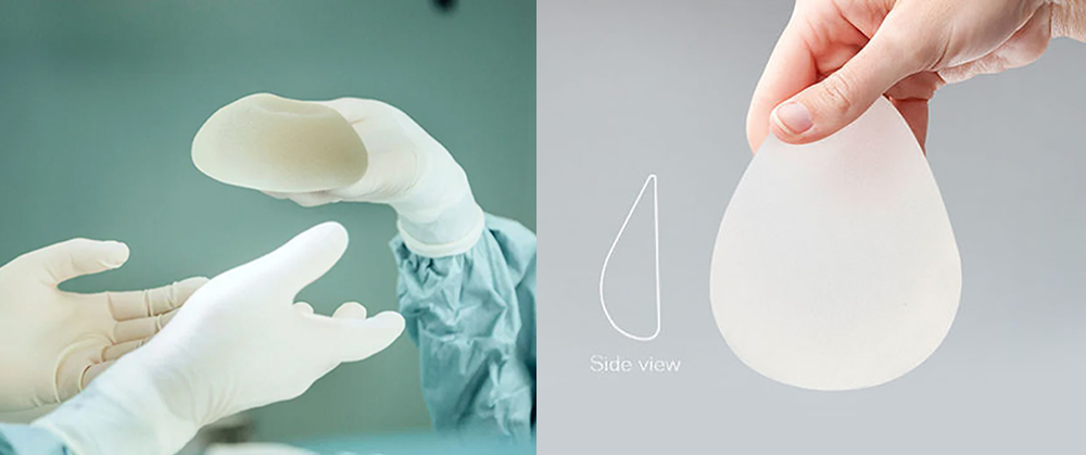 Ưu điểm của nâng ngực túi nhám giọt nước-Dr.Hiếu Liêm q10