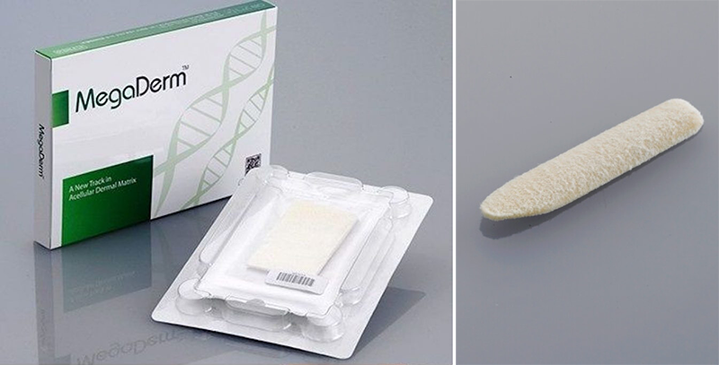 Sụn nhân tạo Megaderm - Dr.Hiếu Liêm Q.10
