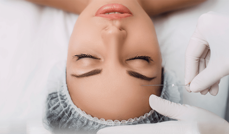 Treo cung chân mày bằng chỉ như thế nào- Dr.Hiếu Liêm Q.10