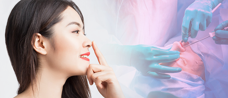 Nâng mũi cấu trúc có tháo ra được không - Dr.Hiếu Liêm Q.10