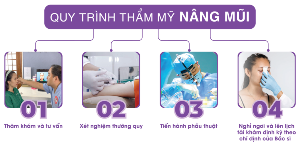 Quy trình nâng Mũi cấu trúc - Dr.Hiếu Liêm Q.10