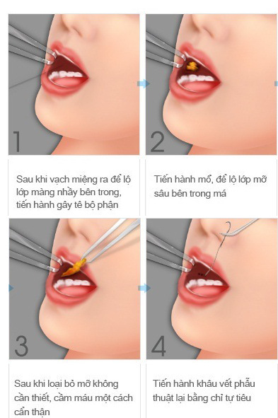 t2-bigimg