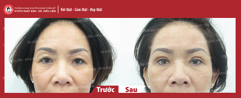 nhan-mi-tao-mi-doi-cat-mi-treo-duoi-cung-may-oanh